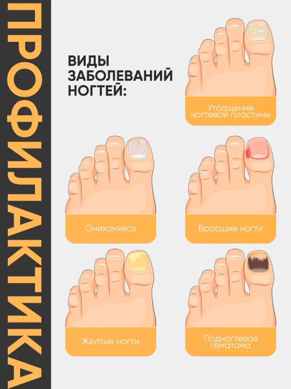 Микосан крем