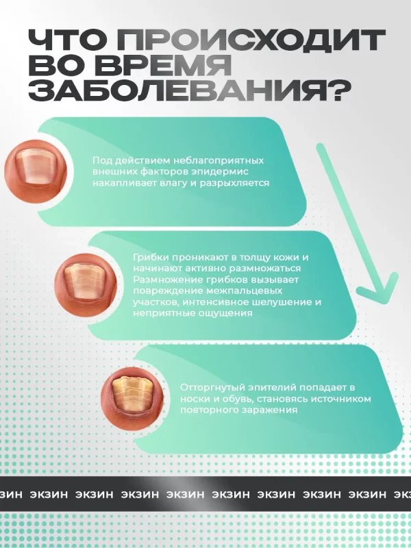 Крем Экзин