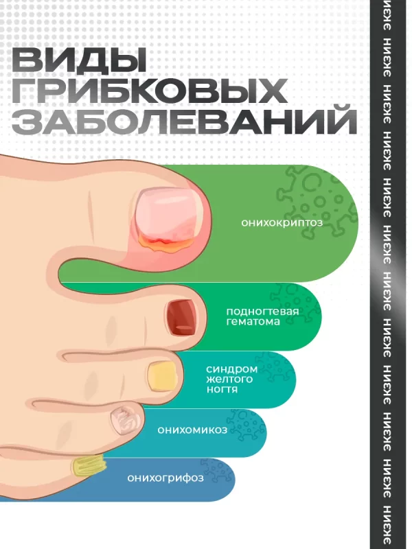 Крем Экзин