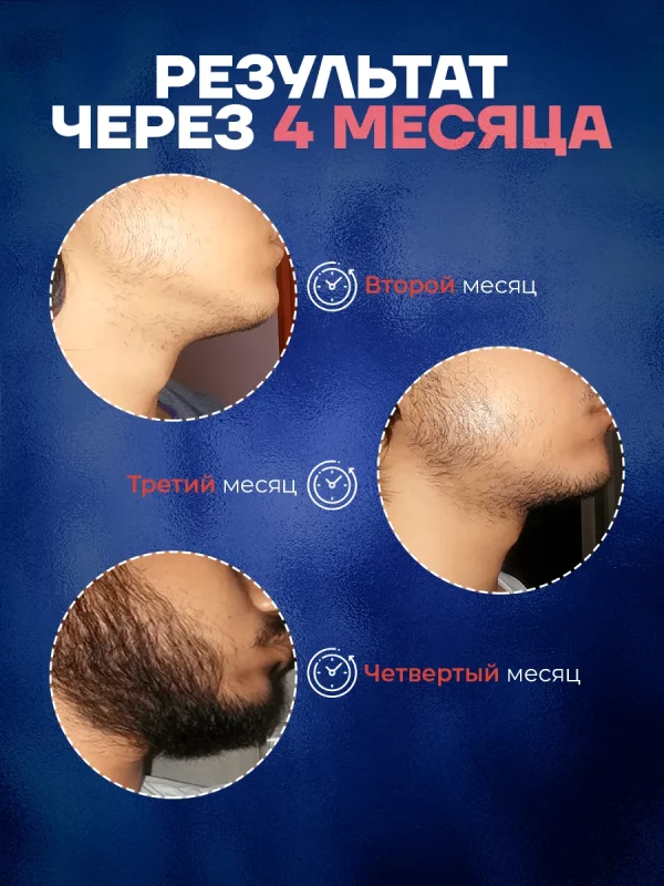 Hair for men