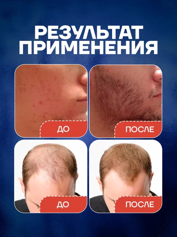 Hair for men